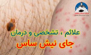 جای نیش ساس