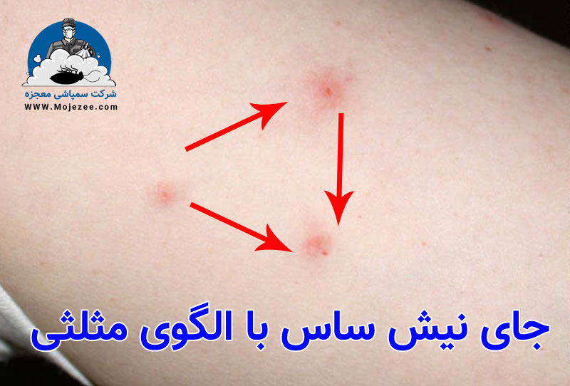 جای نیش ساس با الگوی مثلثی