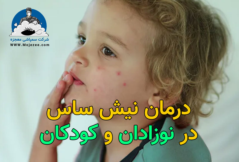 درمان نیش ساس در نوزادان و کودکان