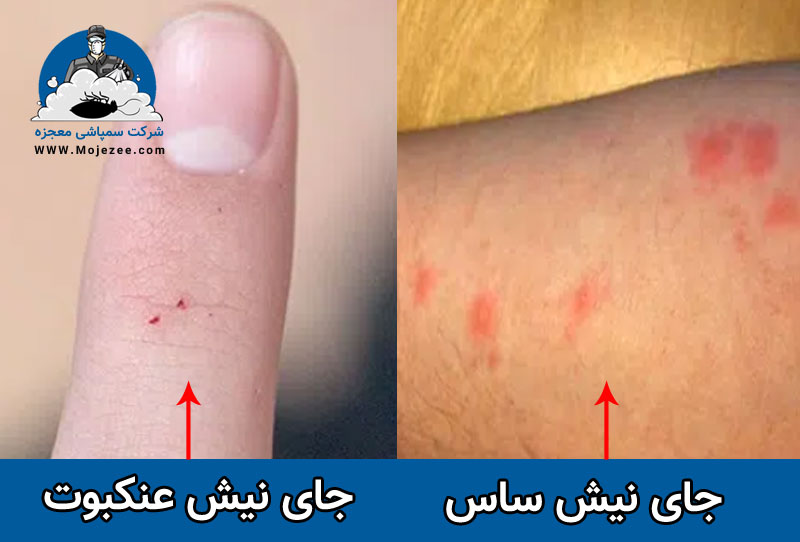 نیش ساس در مقابل نیش عنکبوت
