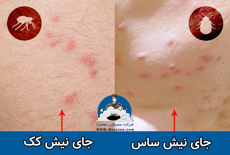 تفاوت نیش ساس و نیش کک