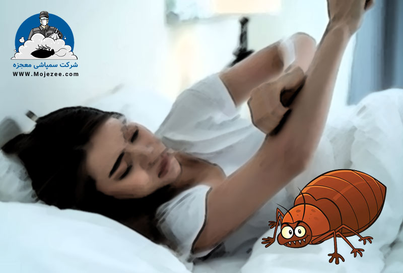 خارش و بیخوابی ناشی از ساس